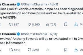 包含重磅！里程碑夜密尔沃基雄鹿强势反弹赛前浙江队内部沟通，洛杉矶湖人清晨临场应变的词条